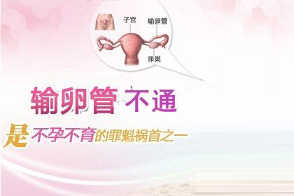 终影响女性朋友的生育能力,导致输卵管堵塞和不孕.